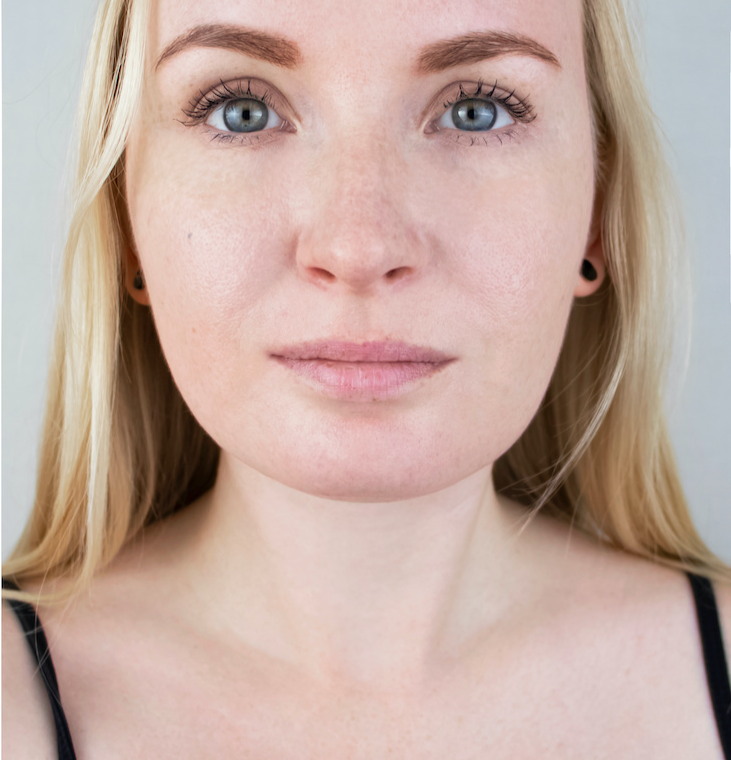 Close-up portrait of after Farmington Med Spa treatment.